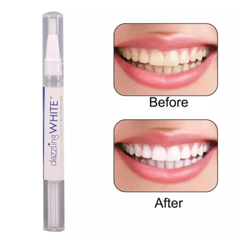 Dazzling White Instant Teeth Whitening Pen